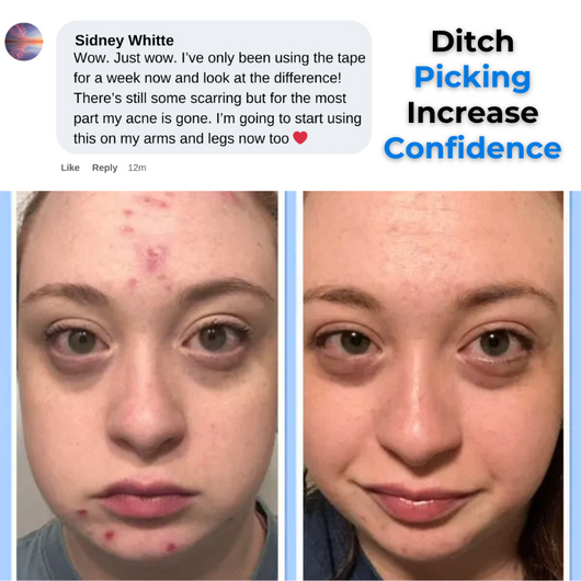 Scalp & Skin Pick-Free Bundles