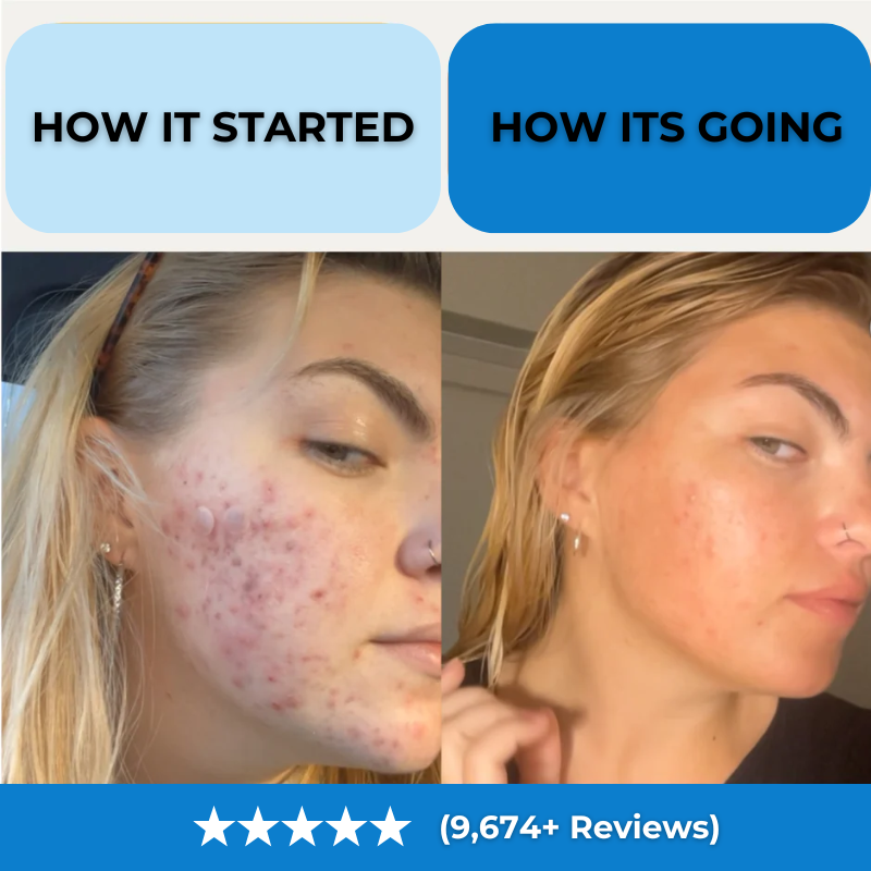 Scalp & Skin Pick-Free Bundles