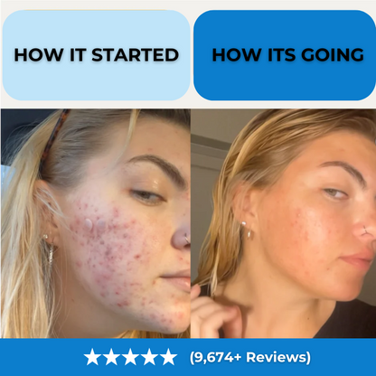 Scalp & Skin Pick-Free Bundles