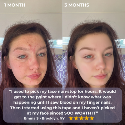 Scalp & Skin Pick-Free Bundles