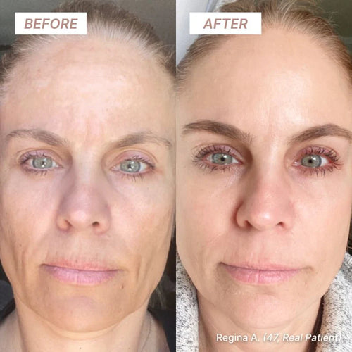 NAD+ EGF Peptide Firming Serum