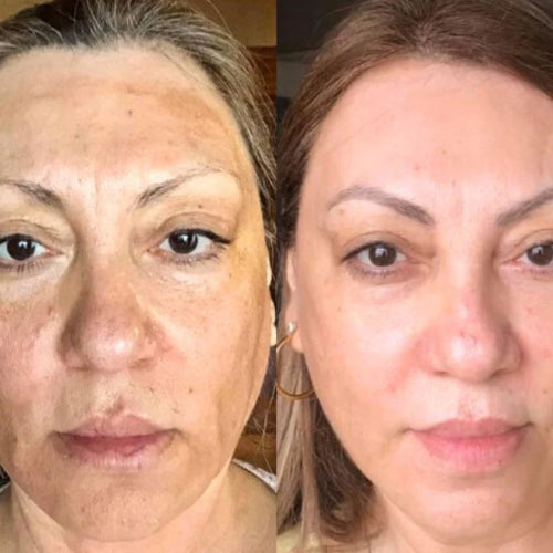 NAD+ EGF Peptide Firming Serum