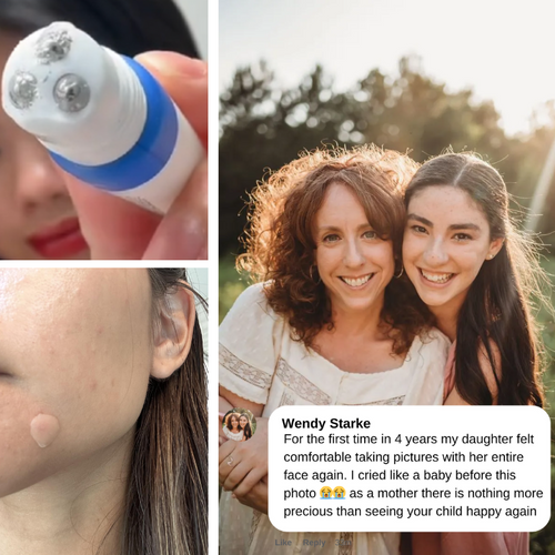 Scalp & Skin Pick-Free Bundles