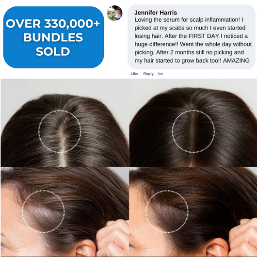 Scalp & Skin Pick-Free Bundles