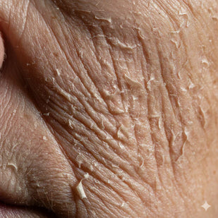fine lines & wrinkles