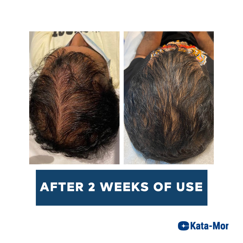 Kata-Mor Advanced Hair Growth Serum