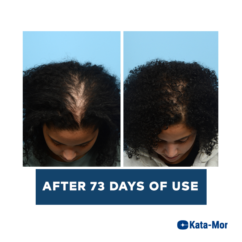 Kata-Mor Advanced Hair Growth Serum