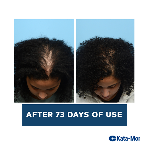 Kata-Mor Advanced Hair Growth Serum