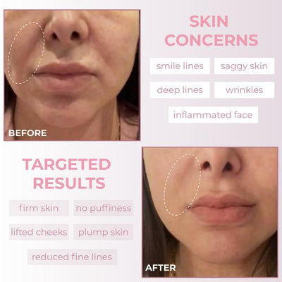 PureSilk Face and Body Massage Tool