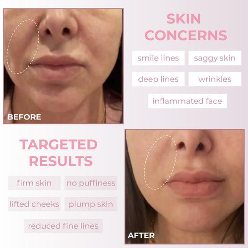 PureSilk Face and Body Massage Tool